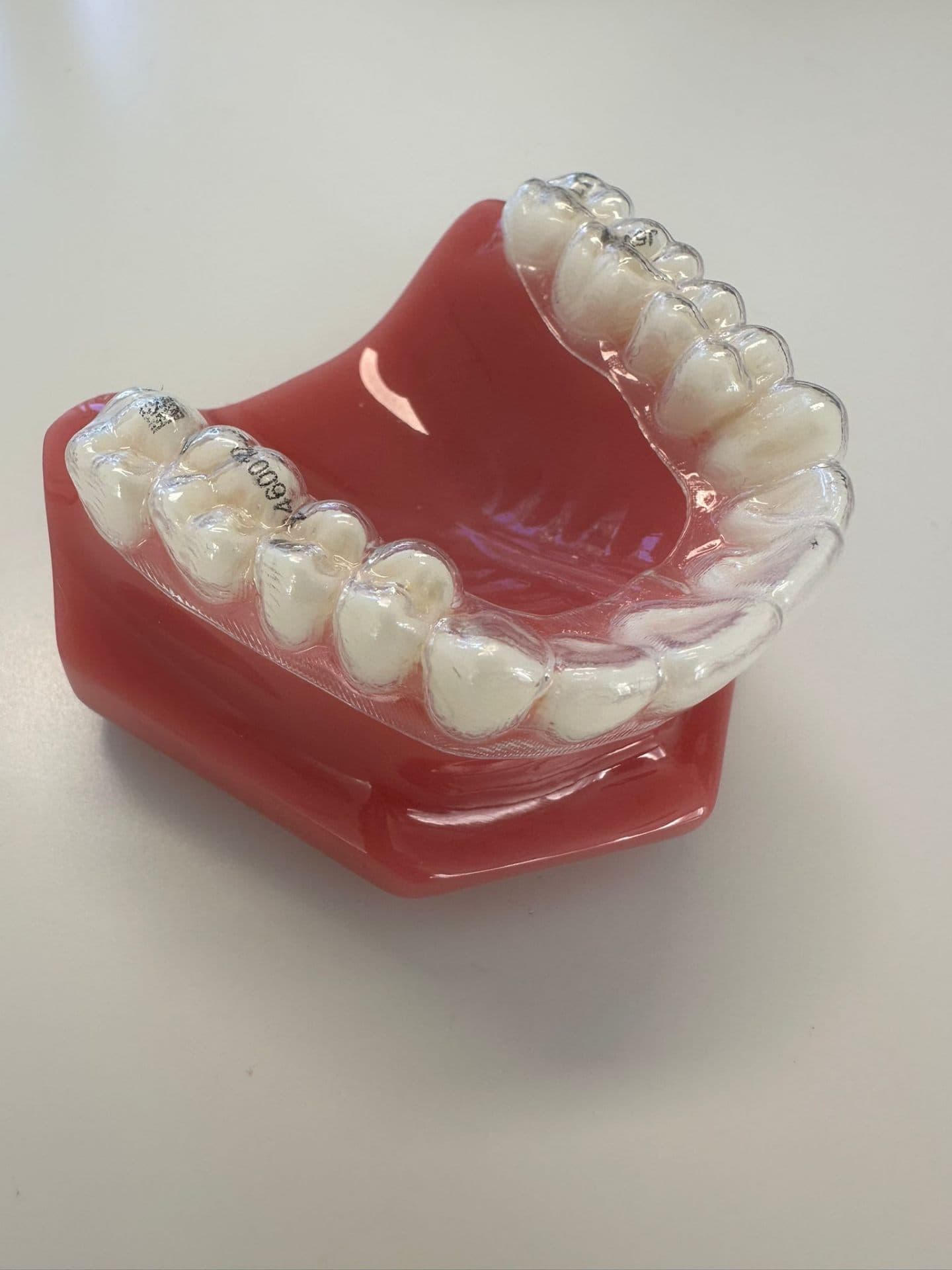 Gouttière orthodontique transparente sur modèle dentaire